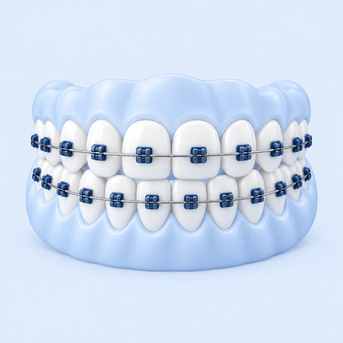 Transparente Aligner-Schiene und feste Zahnspange mit Brackets auf dem Behandlungstisch unserer Praxis in Wallisellen